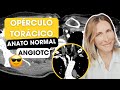 Opérculo toracico! Anatomía normal por angioTC ✅