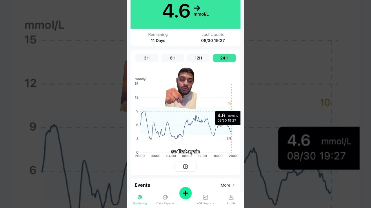 A day with type 1 diabetes 