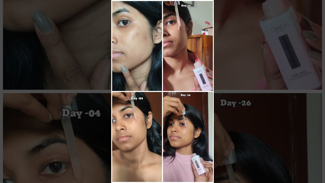 30-Day Challenge with L'Or&eacute;al Paris Glycolic Bright Serum with Melasyl&trade;️