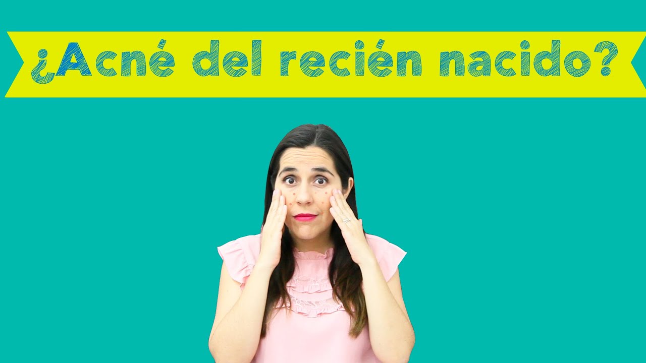 ¿Acné del recién nacido o acné neonatal?