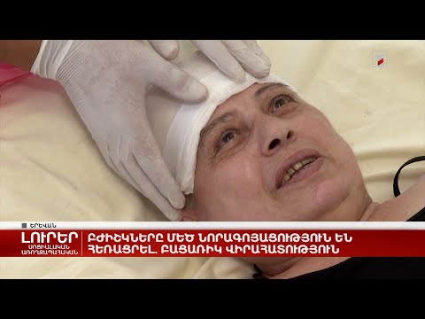 Video: Որո՞նք են հրդեհային օրինաչափությունները: