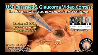 CataractCoach 1370: USF Tampa Cataract \& Glaucoma video contest PLUS bonus video