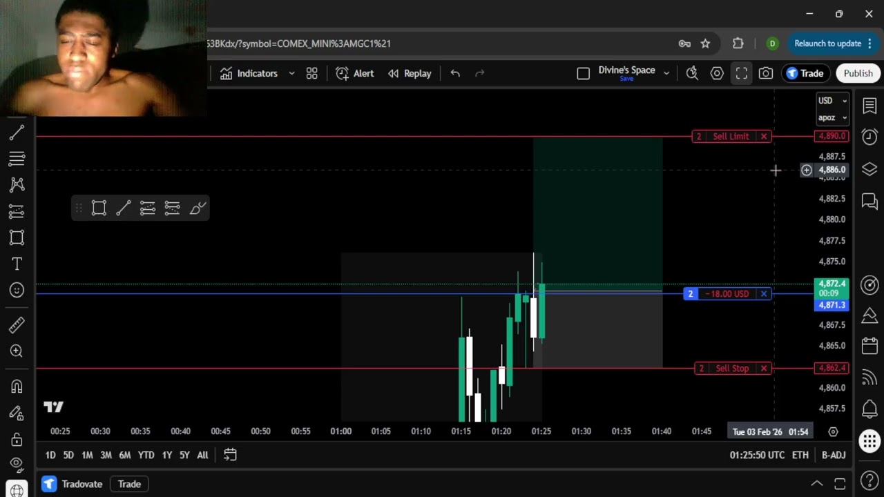 Lost 2 Trades This Monday