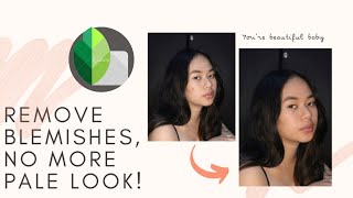 How to remove Acne/Blemishes using Snapseed screenshot 4