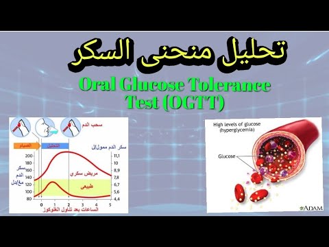 شرح تحليل منحنى السكر وأهميته      تحاليل طبية  