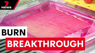 World-first breakthrough growing human-like skin in a lab to help burn victims | 7NEWS