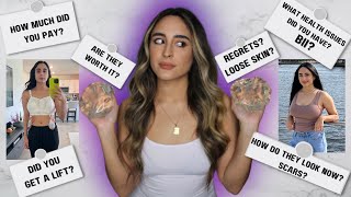 I REMOVED MY BREAST IMPLANTS| Explant Q&A! Are they *saggy*? Cost? Regrets?