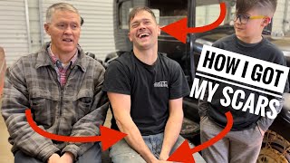 Stories with dad and Ralphie episode 1 how I got my scars