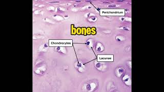 What’s the most abundant type of cartilage in the human body?