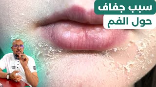 جفاف حول الفم | تقشير الوجه | وصفات الدكتور عماد ميزاب Docteur Imad Mizab