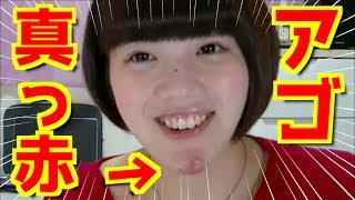 恥ずかしくて外も歩けません‥