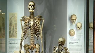 The Irish Giant: Charles Byrne's skeleton removed from display