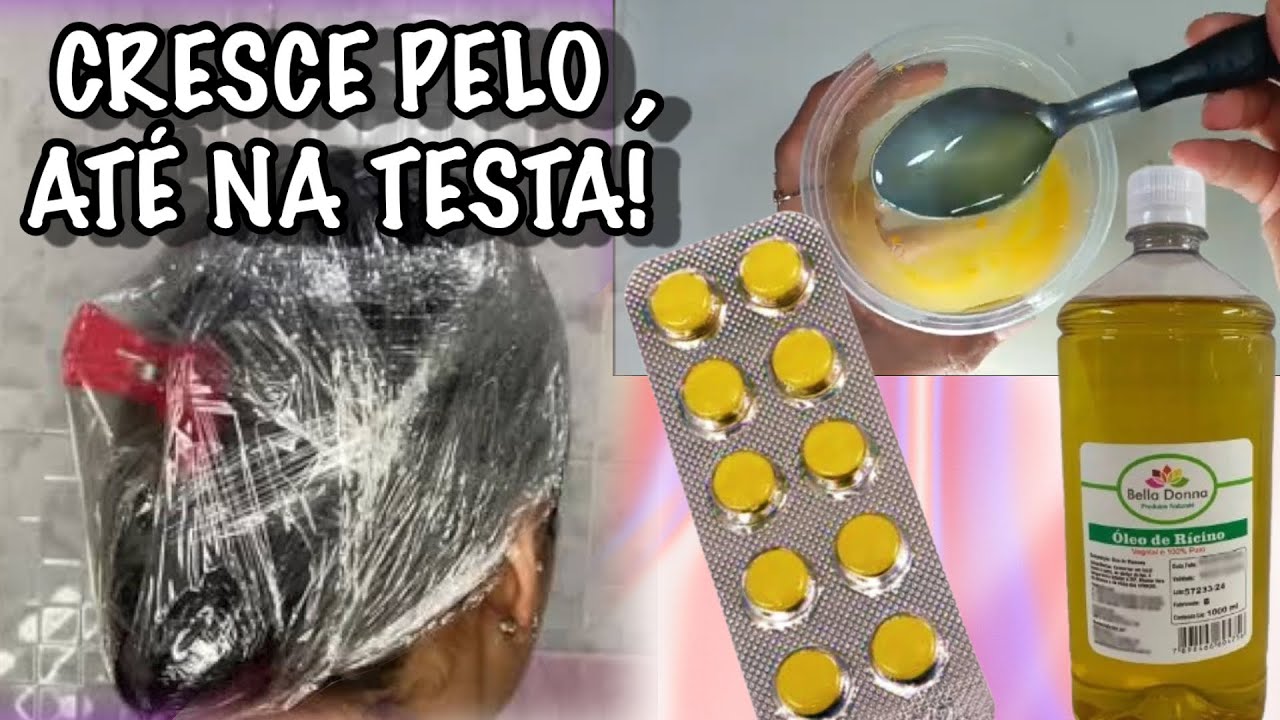 MEU DEUS 😦/ CRESCE IGUAL CAPIM ,ALERTA 🚨CRESCE MUITO RÁPIDO O CABELO!!