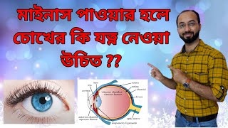 Eye Care In Minus Power | How Minus Power Comes In Eyes |Vitreous Floaters | Vision Test | Eye Care