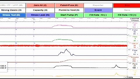 Goby® Performing a Urethral Pressure Profile