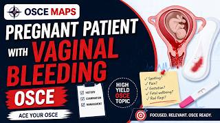 Pregnant Patient with Vaginal Bleeding OSCE