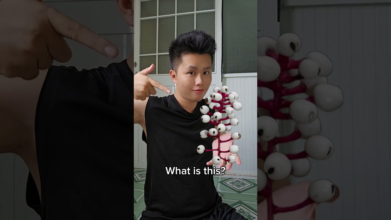 What is this? (P231)