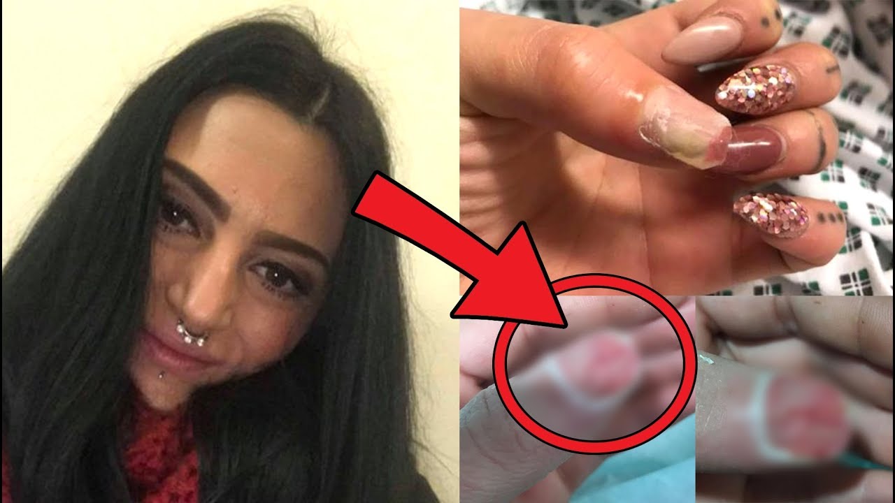 videos de belleza para el cabello NO TE IMAGINAS LO QUE LE PASÓ A ESTA MUJER AL PONERSE UÑAS ACRÍLICAS 😱😢