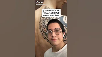 ¿Cuál es el color de tatuaje más difícil de eliminar?