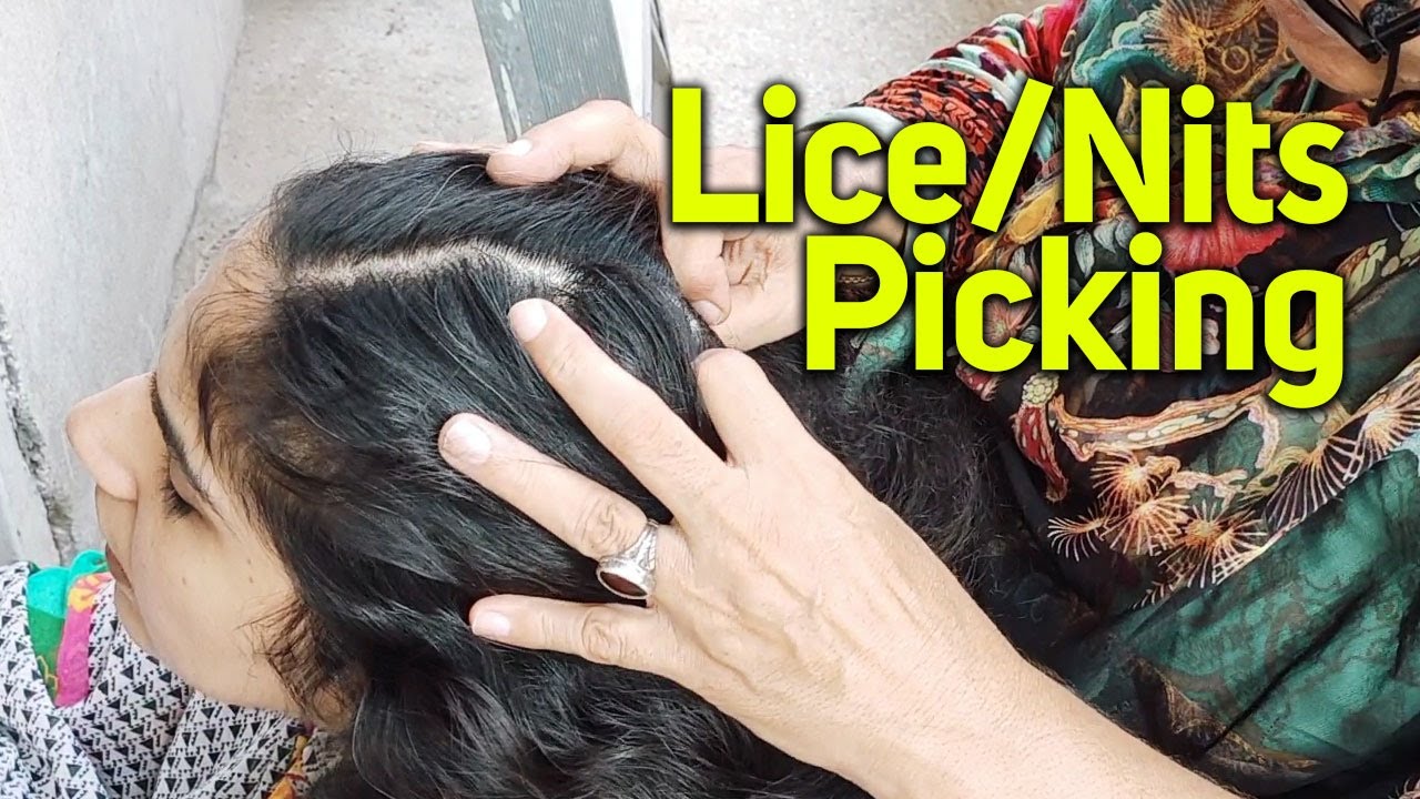 Волосы Вши Гниды Проверка Головы Закрыть Кожа головы Закрыть | ASMR Пакистан