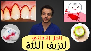 التهاب اللثة - اسباب نزيف اللثة - علاج نزيف اللثة