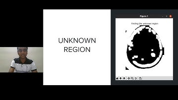 Brain Tumour Detection using Image Processing