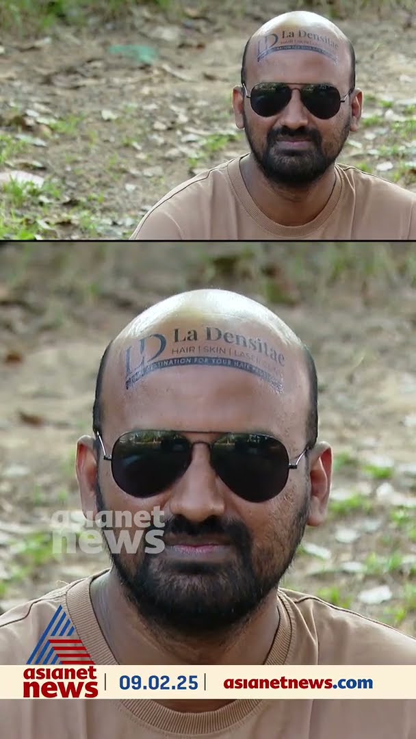 കഷണ്ടി തലയില്‍ പരസ്യം ചെയ്ത് വരുമാനം;  ഷഫീഖിനെ തോല്‍പ്പിക്കാനാകില്ല മക്കളേ