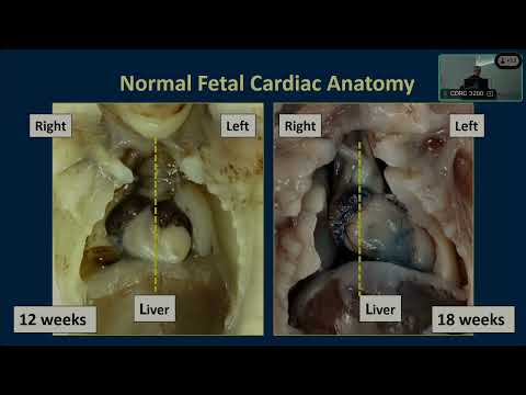 Embryology and Fetal Cardiac Development
