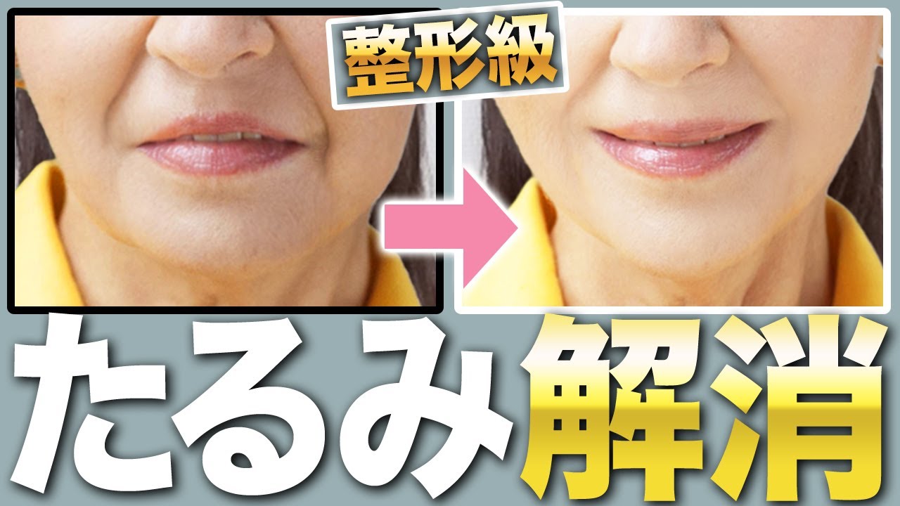 整形級 マリオネットライン たるみを即効消す方法 Youtube