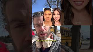 Buccal Fat Removal DOES WHAT😮🤯!?!?!! #Shorts