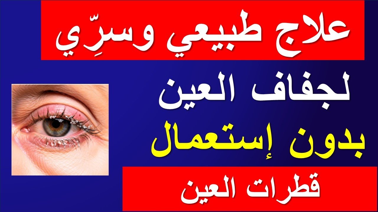 علاج جفاف العين طبيعيًا: 7 طرق بسيطة (بدون قطرات)
