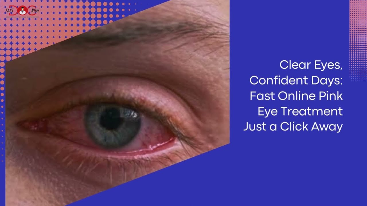 Pink Eye SOS: Your Ultimate Guide to Quick Relief and Rapid Recovery - Pink Eyes Treatment Online