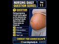 ''Question Series Day 11'' #medicaleducation #internationallyeducatednurse #nursingstudent #quiz