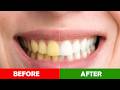 Whiten Yellow Teeth in Photoshop in 60 Seconds!