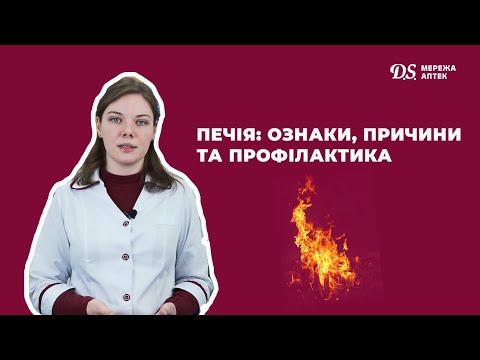 Печія: ознаки, причини та профілактика