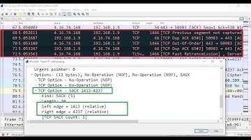 CCNA 200-301 :: 11.How Selective Acknowledgment(SACK) works in TCP using Wireshark in Tamil