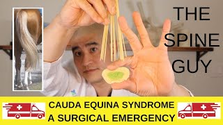 Cauda Equina Syndrome A Surgical Emergency