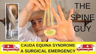 Cauda Equina Syndrome:  A Surgical Emergency