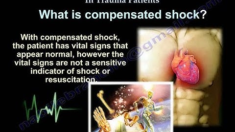 Compensated Shock In Trauma Patients - Everything You Need To Know - Dr. Nabil Ebraheim