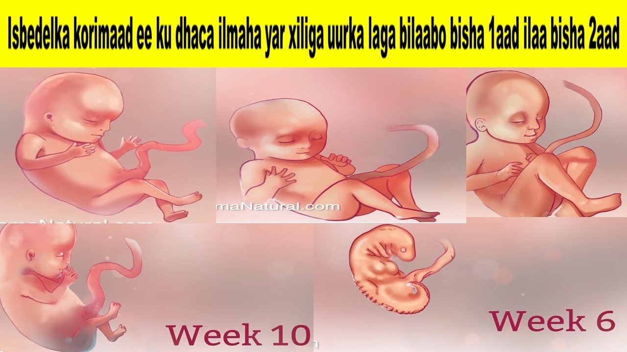 Isbedelka korimaad ee ku dhaca ilmaha yar xiliga uurka laga bilaabo bisha 1aad ilaa bisha 2aad