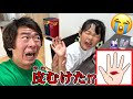 パパのせいで手の皮がむけた⁉️なんでパパのせいにするのよ〜〜〜〜〜😭💦【実話再現】