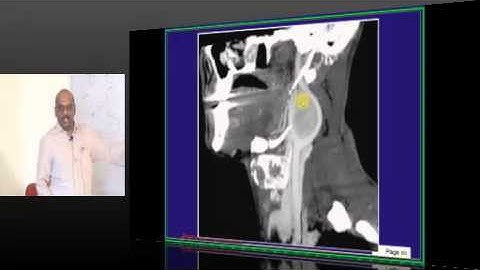 NEETPG Image Based MCQ Discussion in AIPGMEE Mock Test 1381 Lec 01
