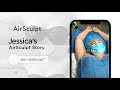 Airsculpt patient journey jessicas arm airsculpt procedure