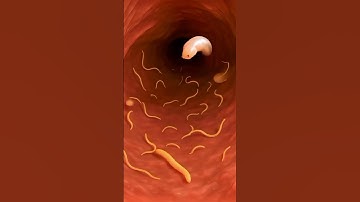 inside the digestive tract  Worm