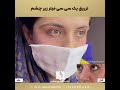 تزریق فیلر زیر چشم در شیراز توسط دکتر مهسا پور هاشمی