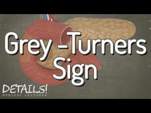 Grey-Turners Sign | Details