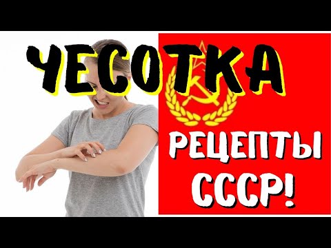 КОПЕЕЧНЫЕ РЕЦЕПТЫ из СССР от ЧЕСОТКИ!  100 РАБОТАЕТ