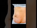 If You Have Belly Fat + Love Handles + Bloated Stomach, Do These Exercises Every Day
