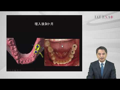 岩手医科大学 近藤教授ご講演】安心・安全にインプラント治療を