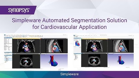 Simpleware Automated Segmentation Solution for Cardiovascular Application | Synopsys